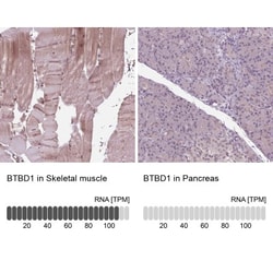 BTBD1 Antibody, Novus Biologicals 25 &mu;L, Unlabeled:Antibodies, Polyclonal